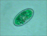 kirchneriella_sp1c